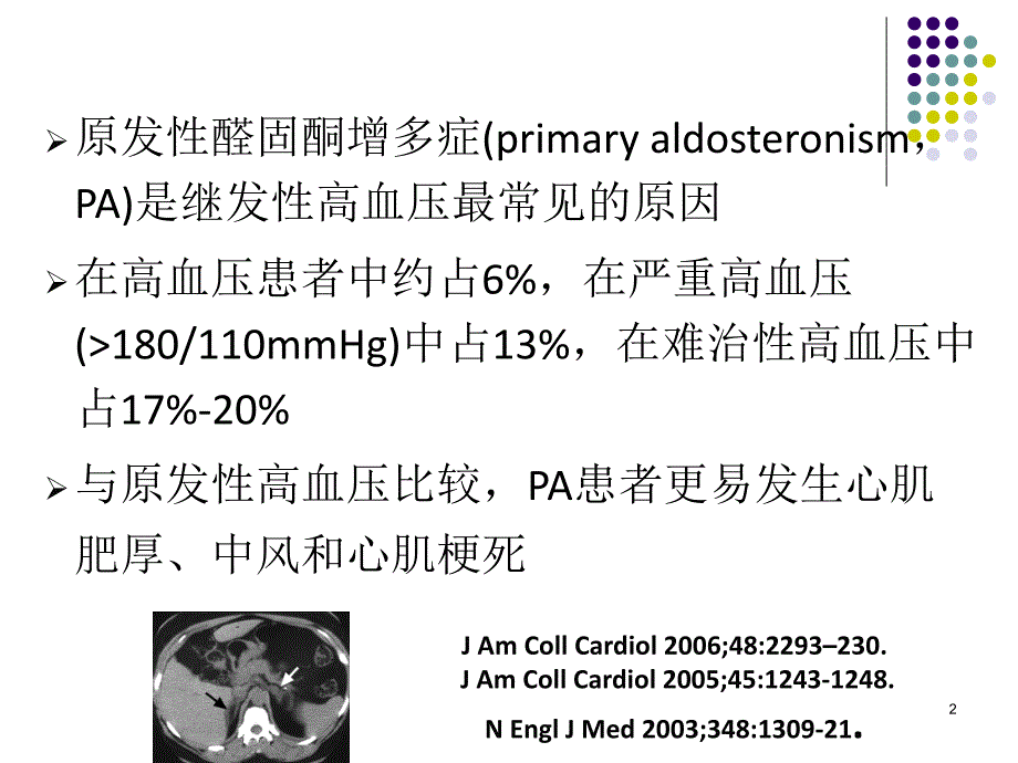 医学课件分侧肾上腺静脉取_第2页