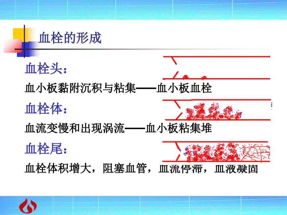 病理学：局部血液循环障碍文档资料_第3页