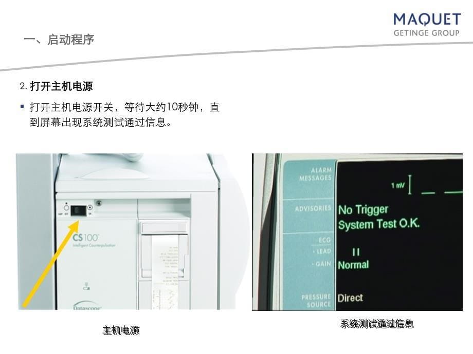 iabp操作(机器及植入)方法技巧_第5页