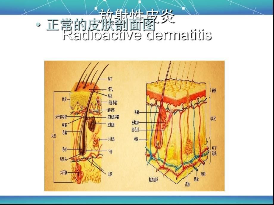 乳腺癌放疗后的皮肤护理PPT课件123_第5页