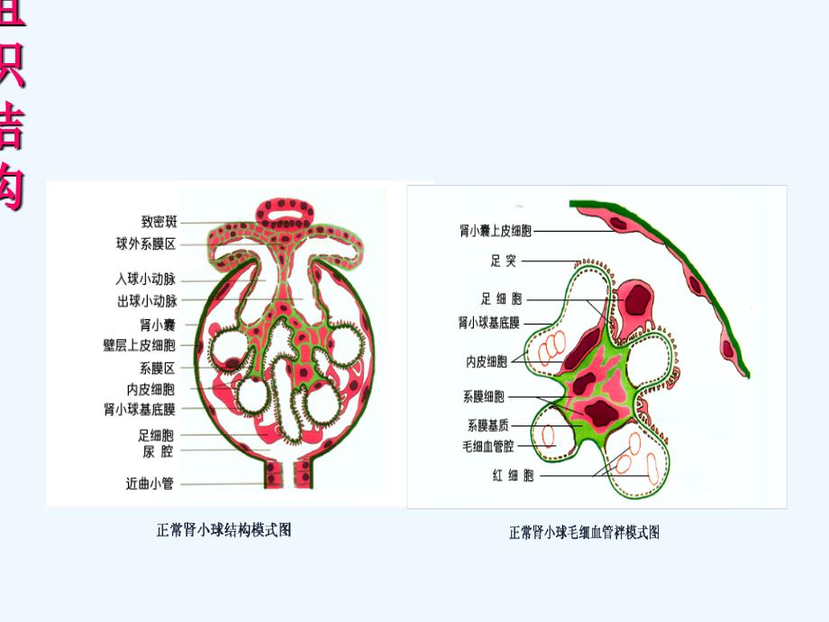 肾脏病课件医学课件_第4页