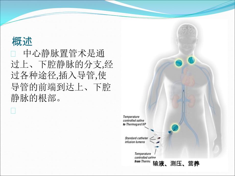 中心静脉置管术的护理(1)_第2页