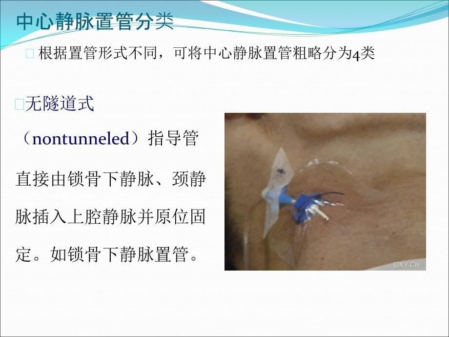 中心静脉置管术的护理(1)_第5页