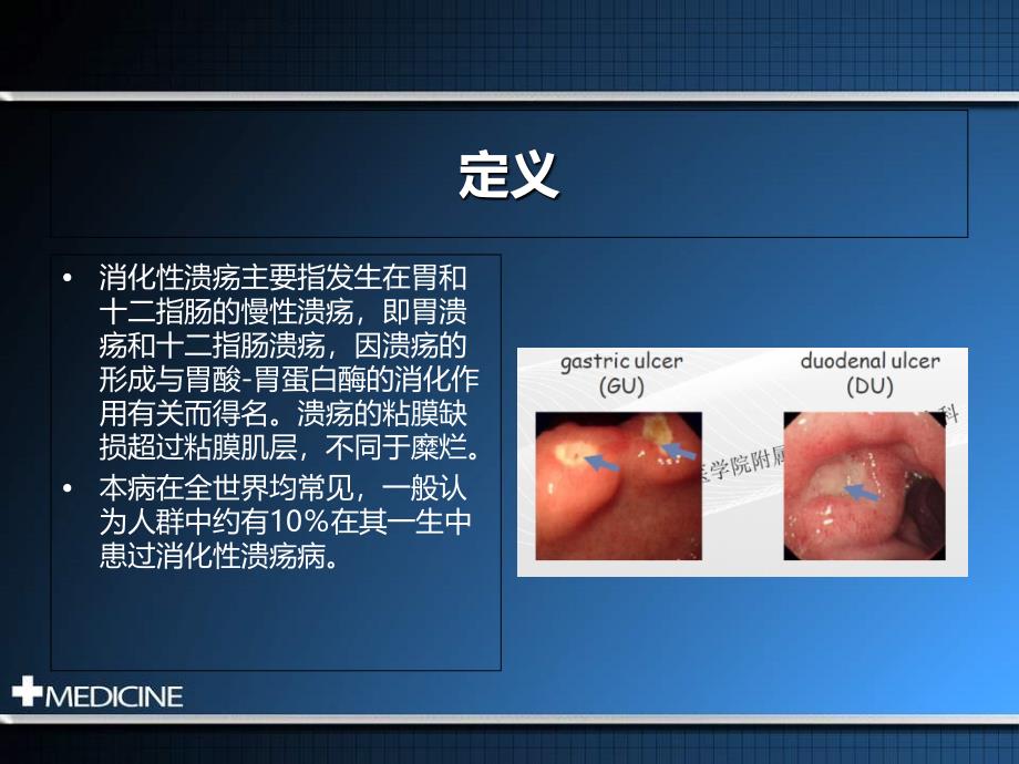 消化性溃疡诊断和治疗规范建议_第2页