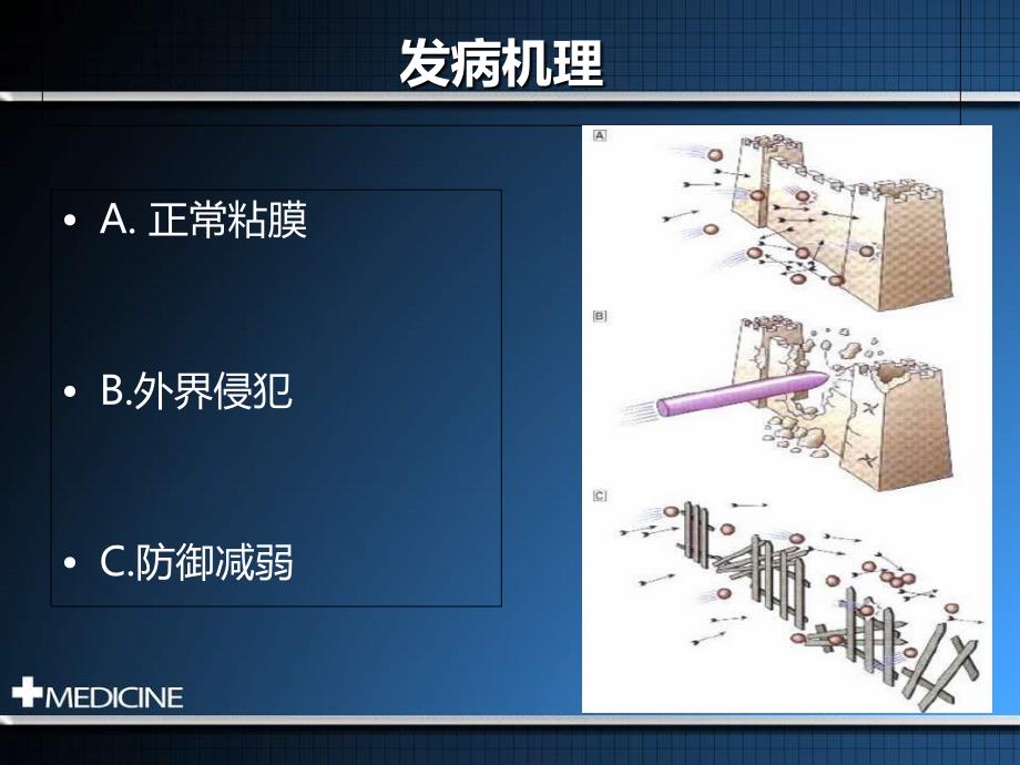 消化性溃疡诊断和治疗规范建议_第4页