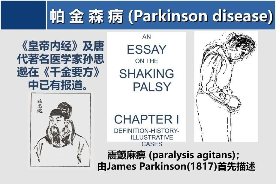 神经内科学课件：帕金森病－整合_第5页