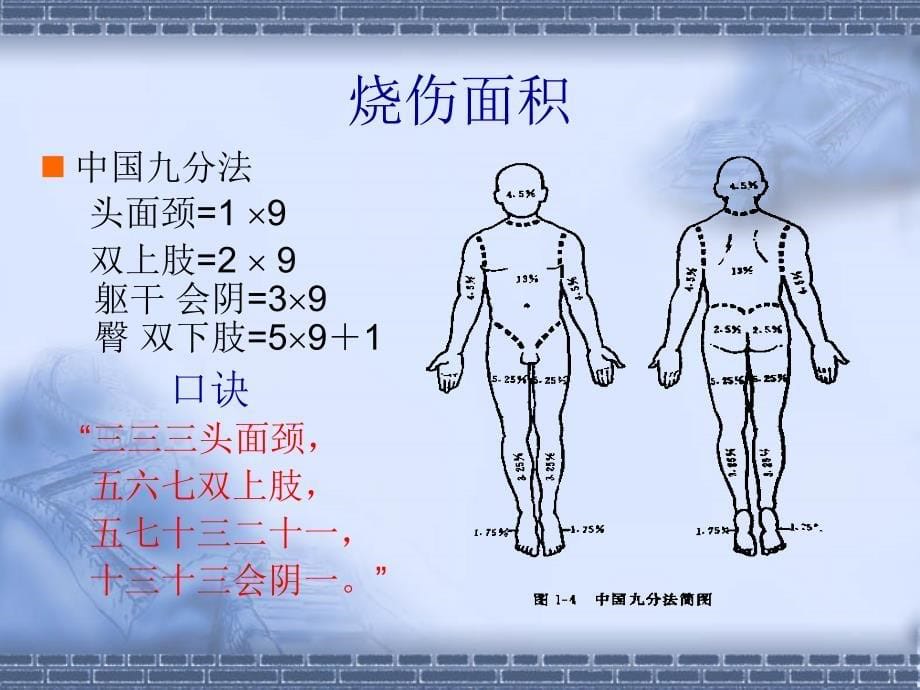 第十三节、烧伤课件_第5页