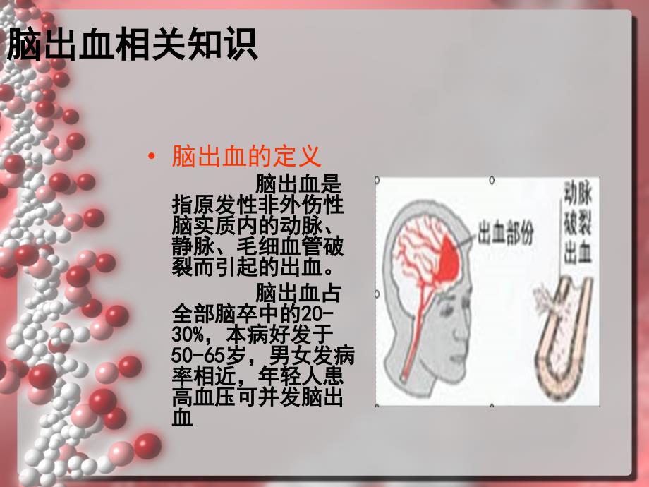 脑出血病人的护理查房_第4页