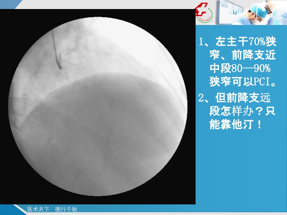 冠心病介入病例和他汀的应用ppt课件_第3页