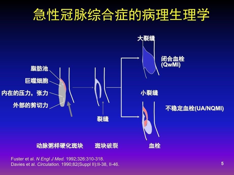 急性冠脉综合症的诊治进展-急诊.ppt_第5页