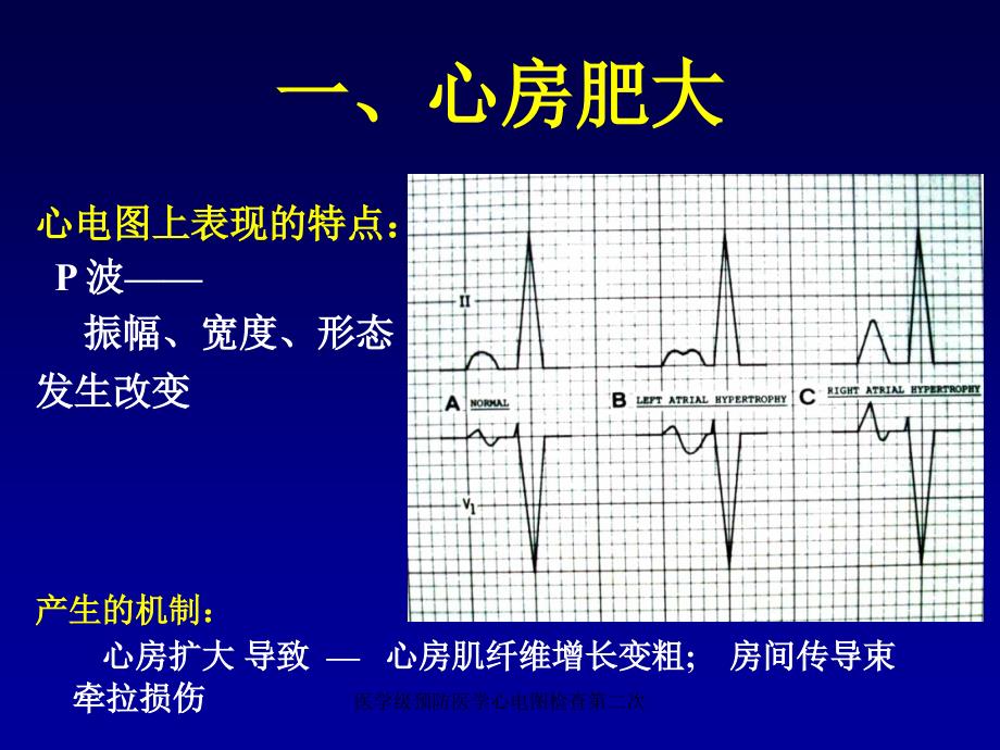 医学级预防医学心电图检查第二次课件_第2页