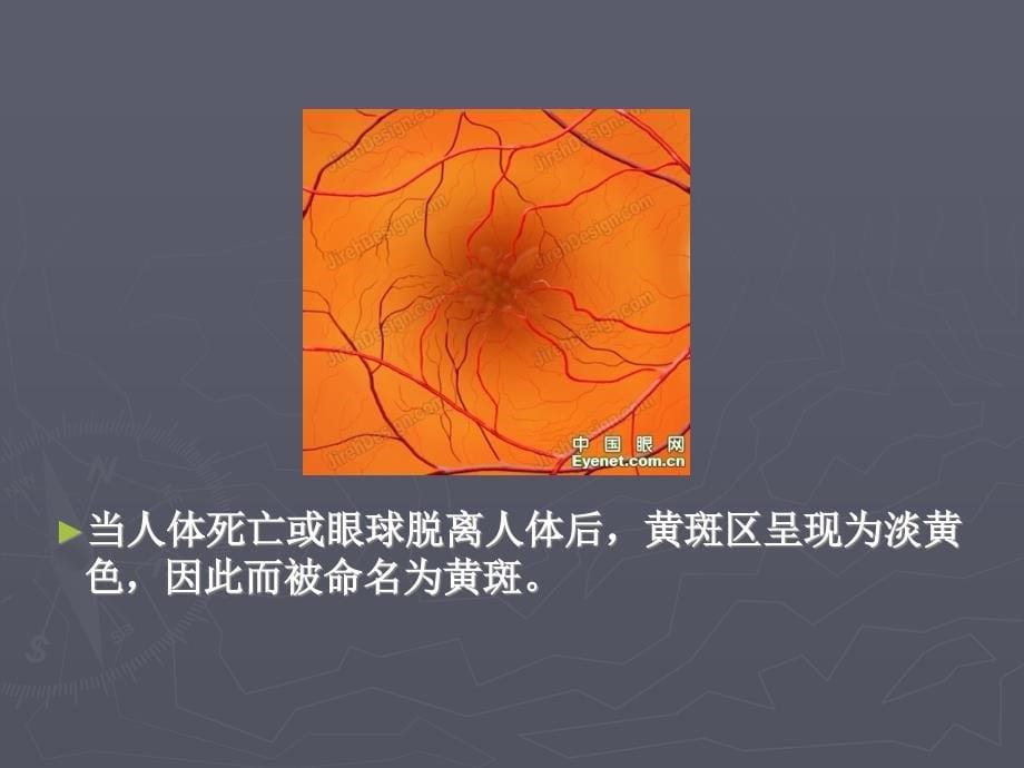 老年性黄斑变性.ppt_第5页