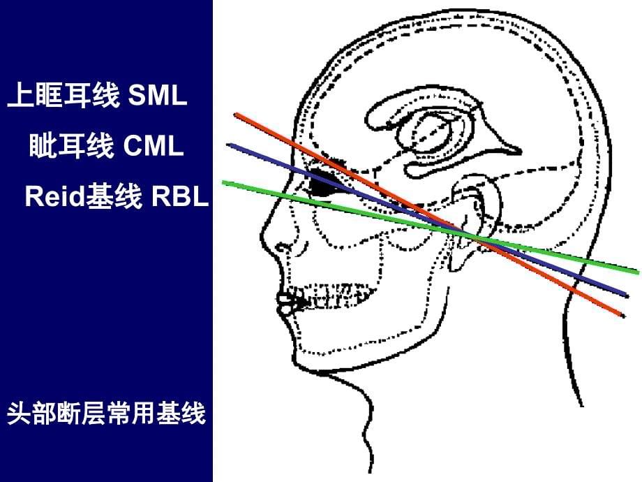 头部断层解剖学人体断层解剖学课件02_第5页