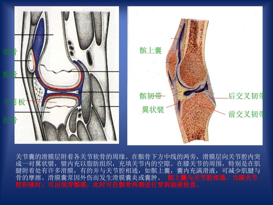 《膝关节穿刺术》PPT课件_第4页