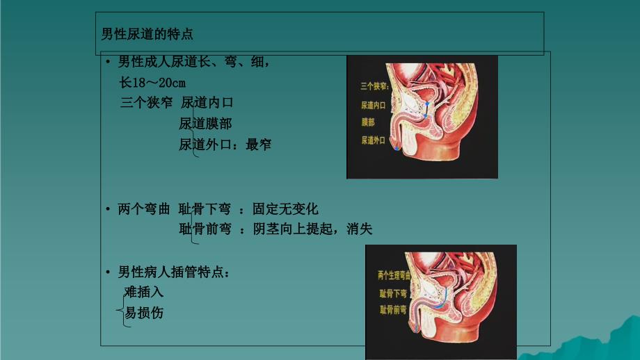 留置导尿技术操作45干货分享_第4页