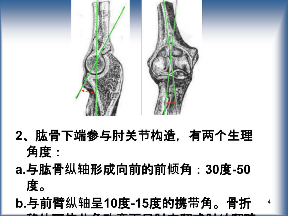 （优质课件）肱骨髁上骨折.自制完整版_第4页