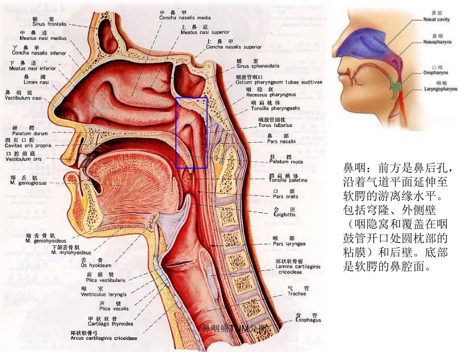 鼻咽癌TNM分期课件_第3页