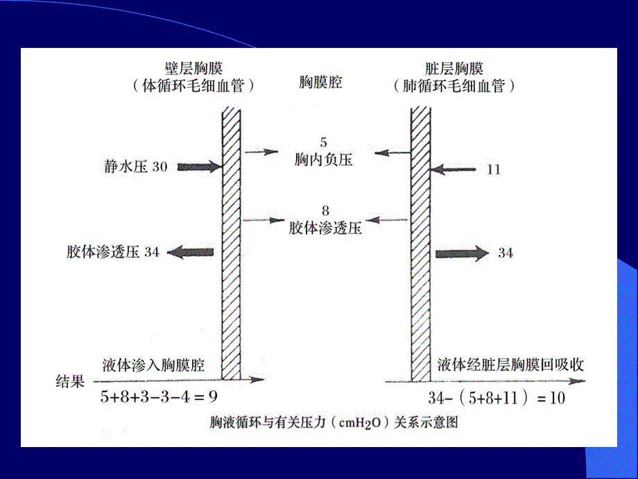 胸腔积液多媒体PPT课件_第3页