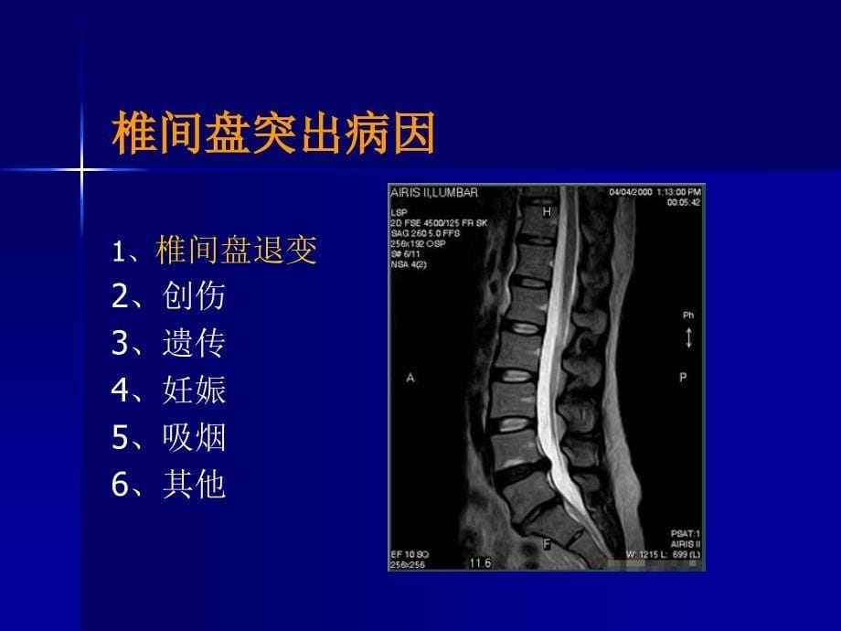 外科学课件：腰腿痛和颈肩痛_第5页