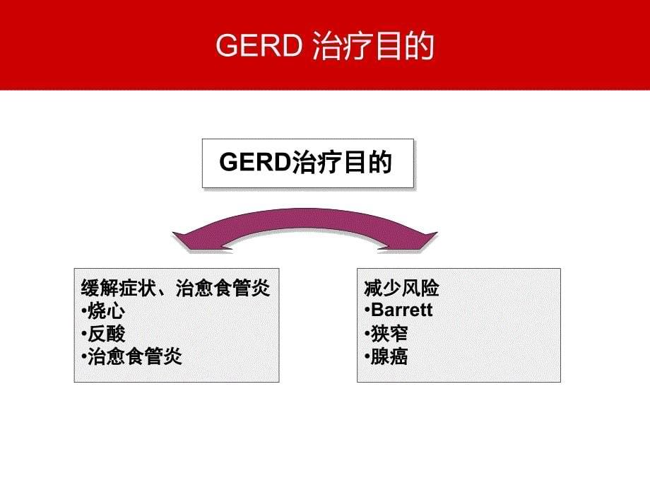 胃食管反流病GERD治疗.ppt_第5页