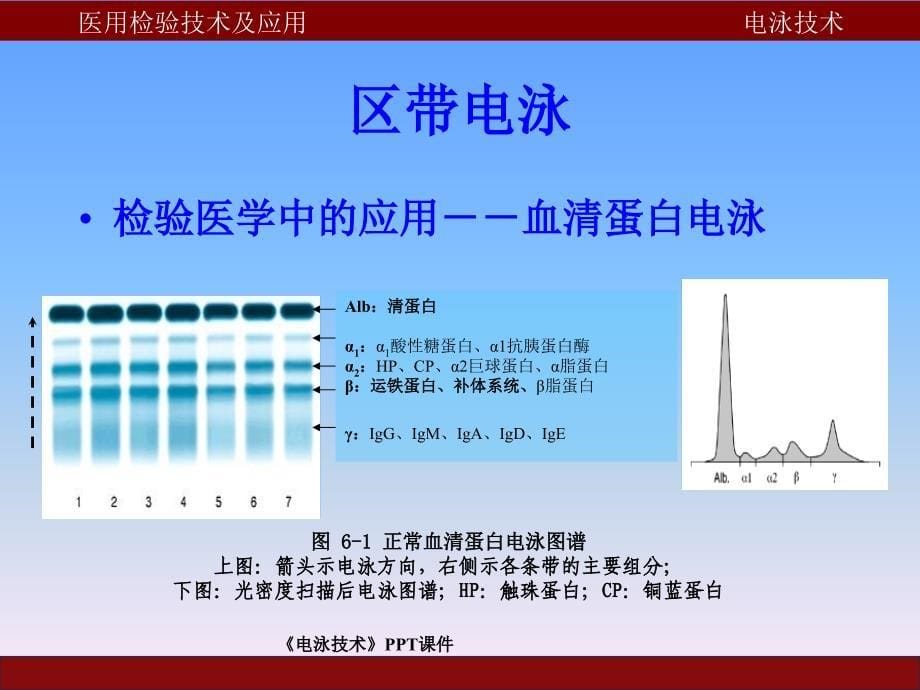 电泳技术课件_第5页