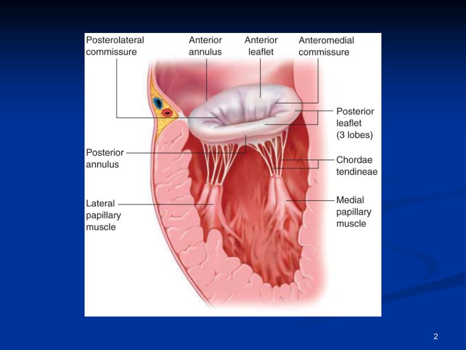 心脏瓣膜病ppt课件_第2页