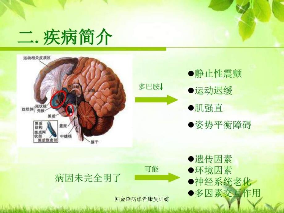 帕金森病患者康复训练课件_第3页