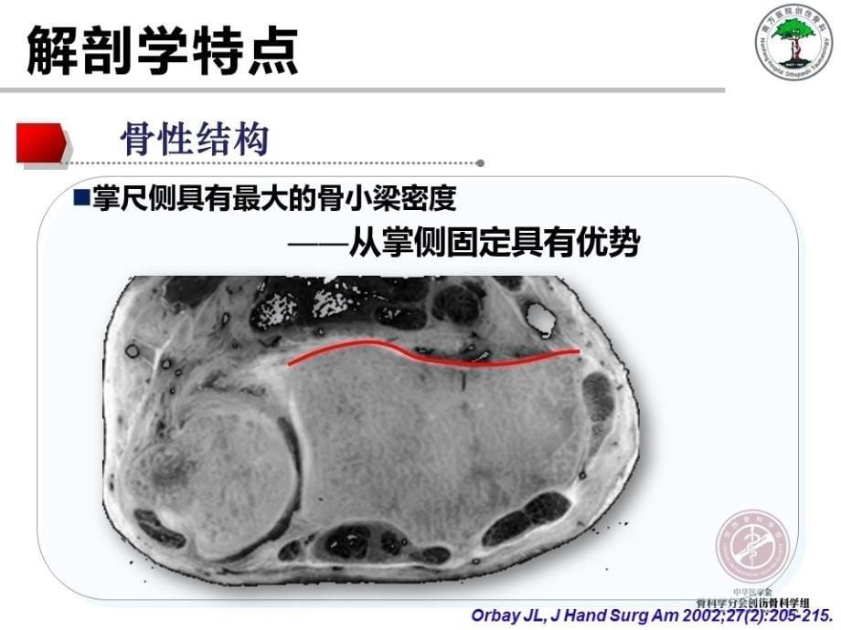 桡骨远端骨折的解剖及手术入路-南方医院-余斌_第5页