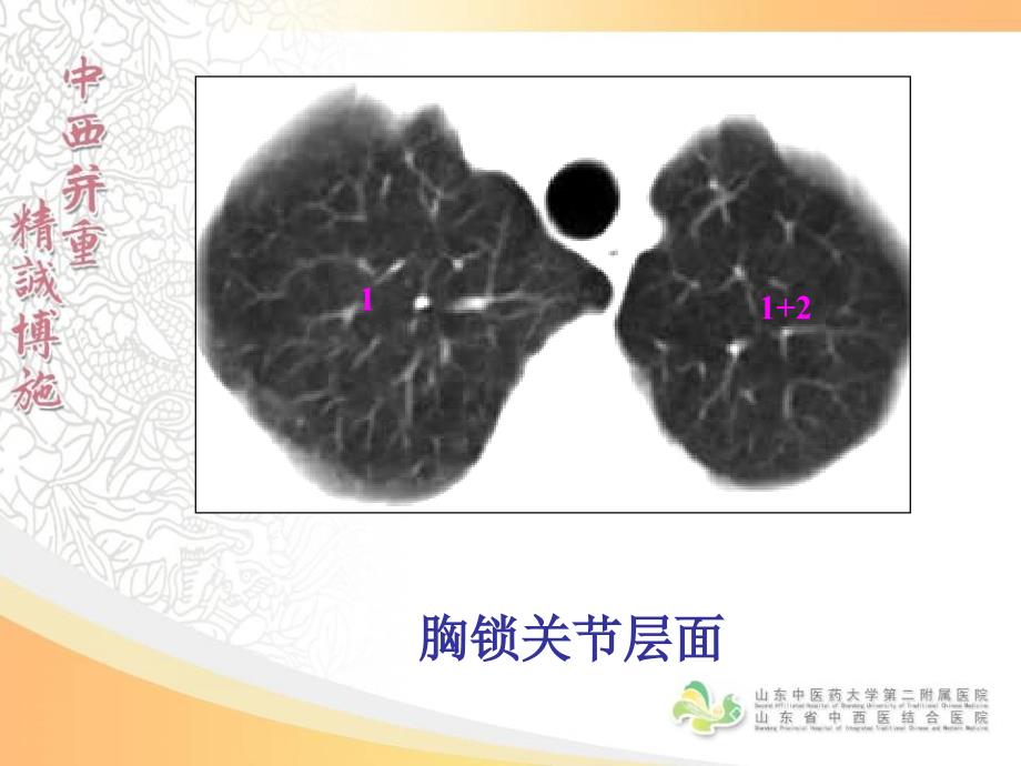 胸部影像学--CT篇_第4页