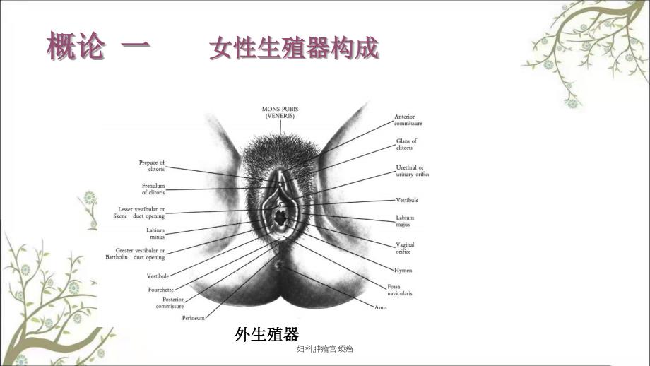 妇科肿瘤宫颈癌课件_第2页