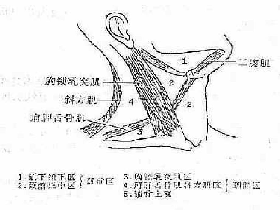 颈部疾病的鉴别诊断PPT课件_第3页