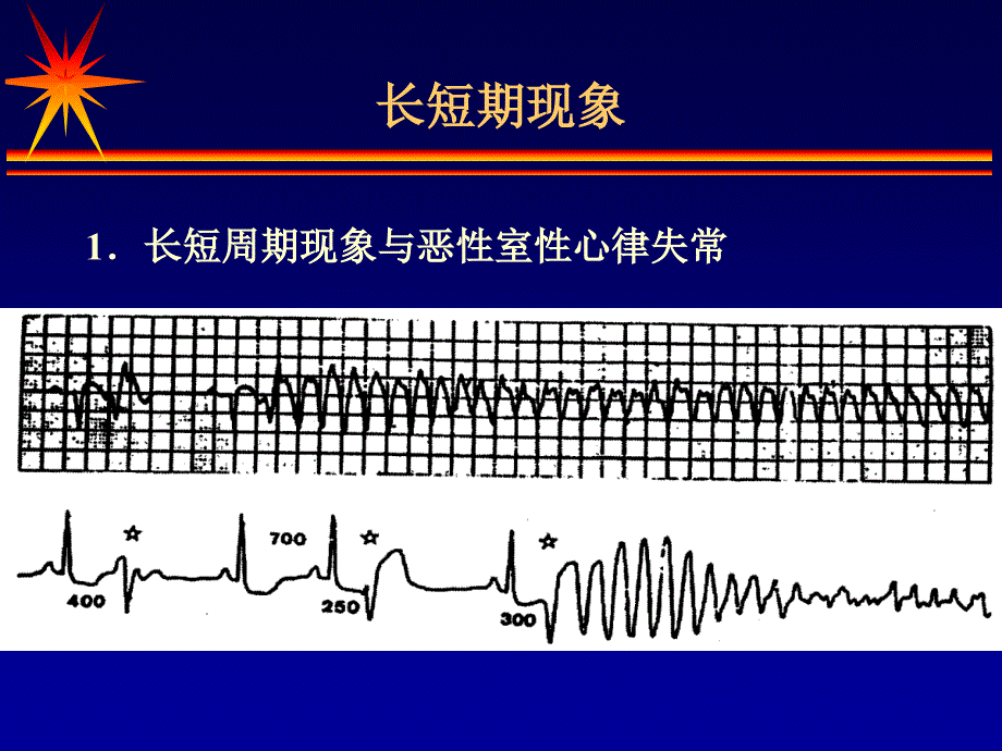 心律失常心电图的几个特殊现象_第3页