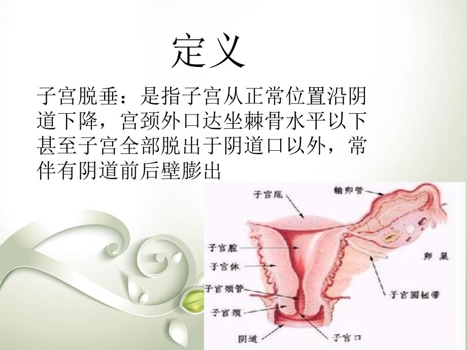 子宫脱垂护理查房_第4页