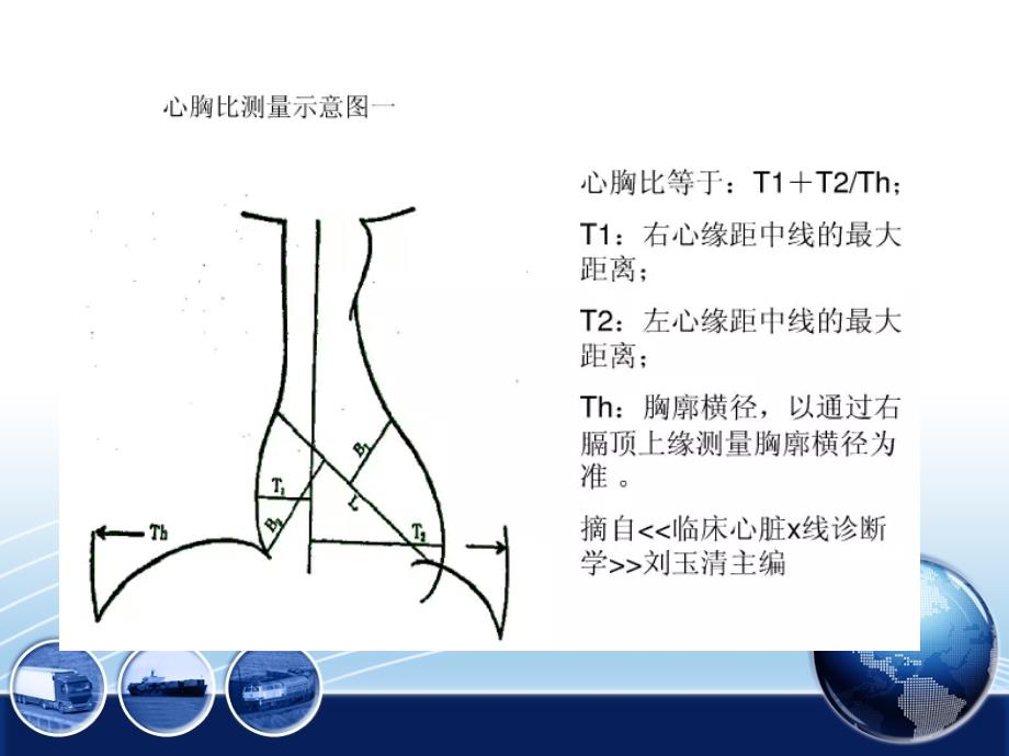 常见心脏病变的X线诊断_第3页