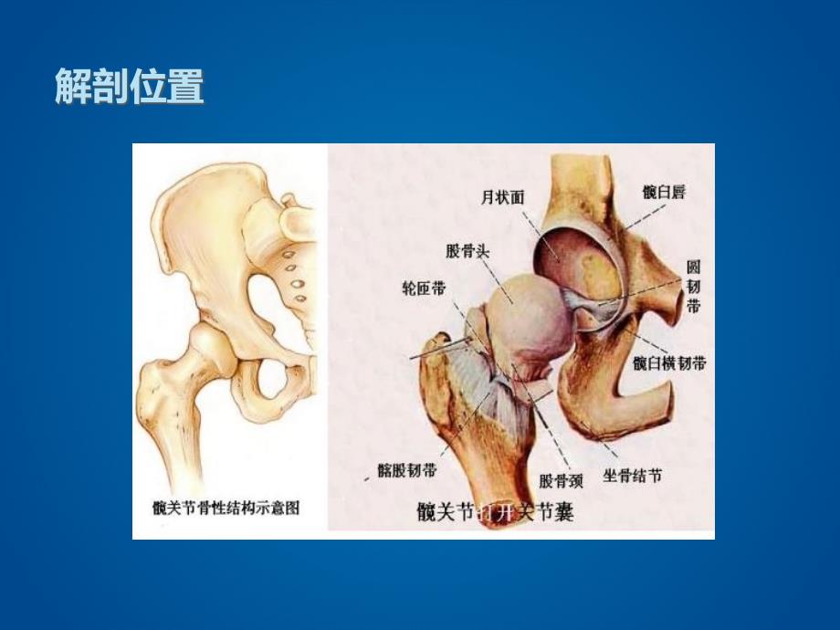 髋关节置换术护理PPT演示课件_第3页