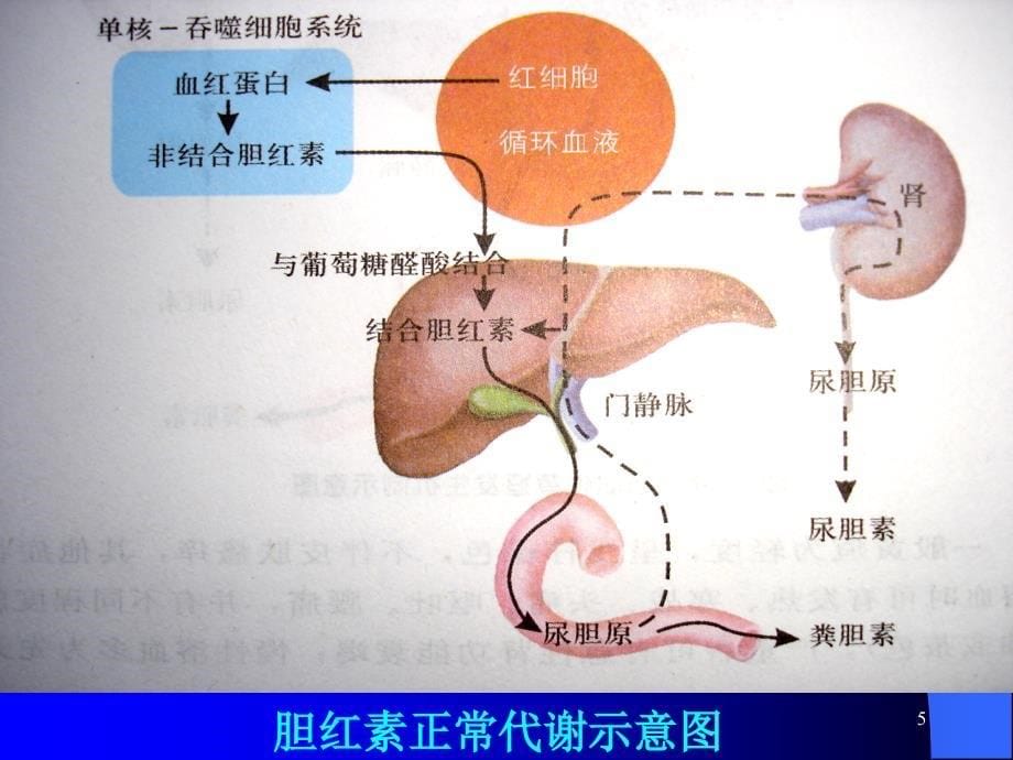 诊断学-黄疸PPT课件_第5页