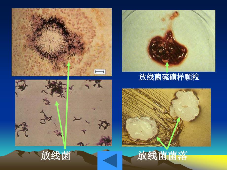 病原生物实验课：实验十三、衣原体、支原体、立克次体 、螺旋体、放线菌的形态观察_第4页