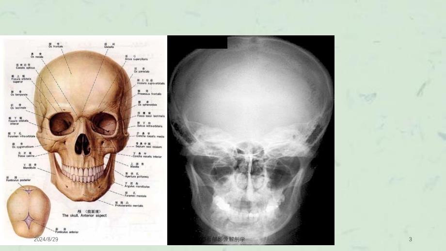颜面部影像解剖学课件_第3页