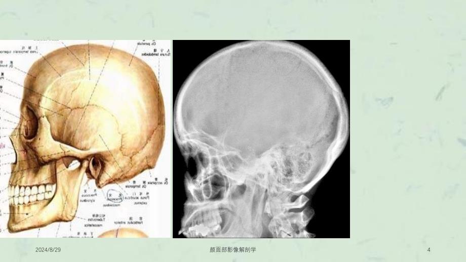 颜面部影像解剖学课件_第4页