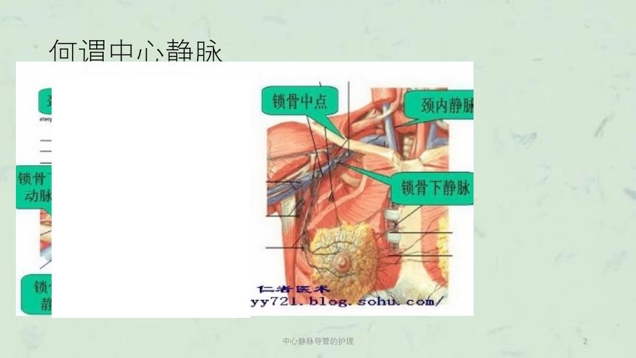 中心静脉导管的护理课件_第2页