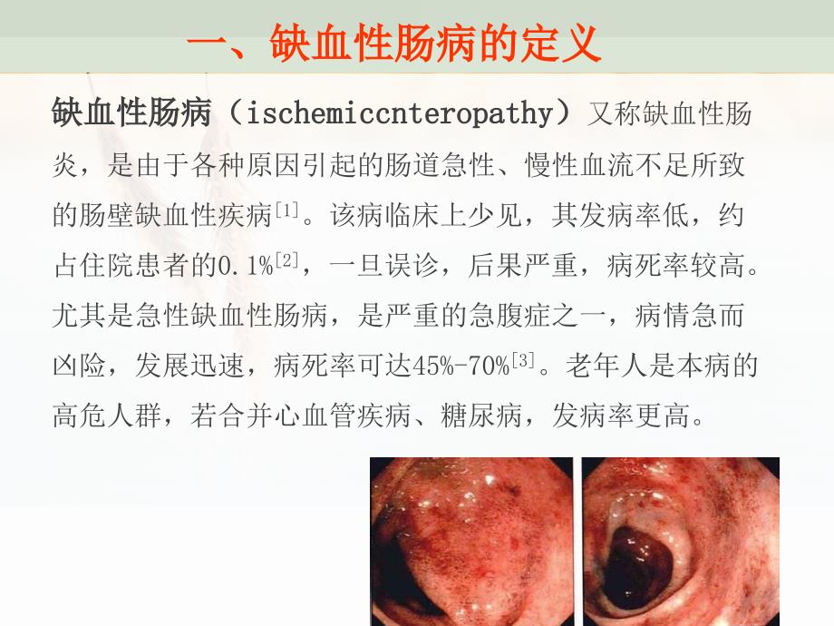 缺血性肠病治疗及护理_第3页