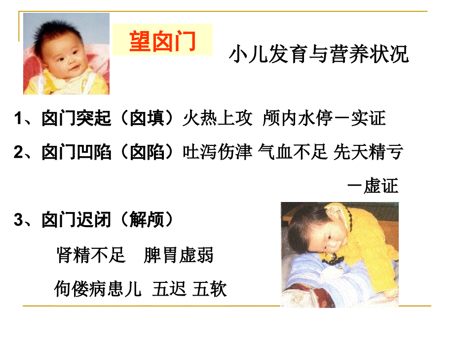 b3望头五官颈皮肤二阴小儿络脉.ppt_第4页