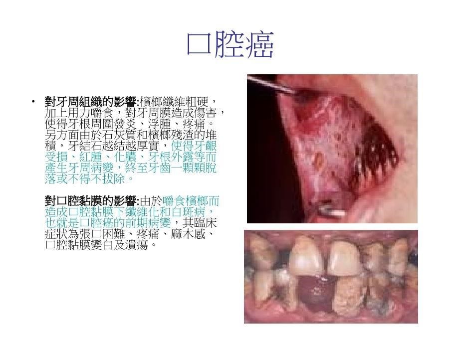 为什么那么多人吃槟榔课件_第5页