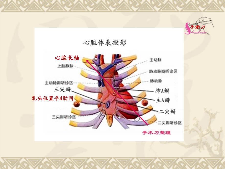 心脏超声常规切面及手法操作课件.ppt_第3页