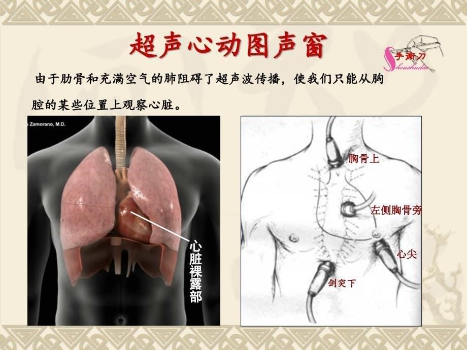 心脏超声常规切面及手法操作课件.ppt_第5页