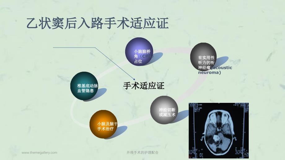 开颅手术的护理配合课件_第4页