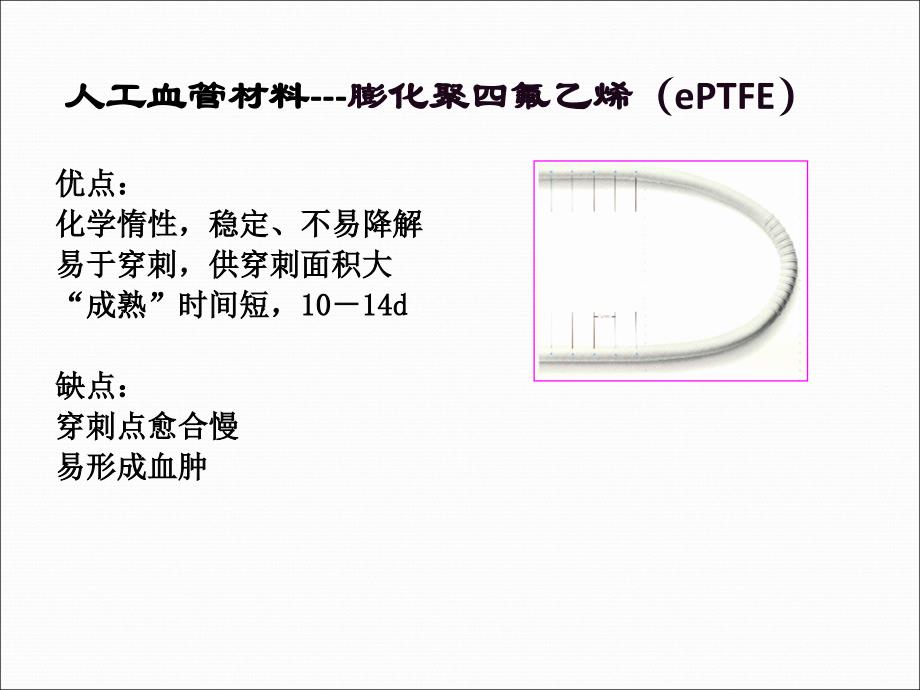 人工血管的绳梯穿刺海淀医院 PPT课件.ppt_第2页