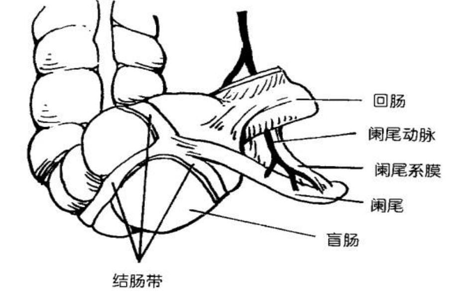 急性阑尾炎幻灯片_第5页