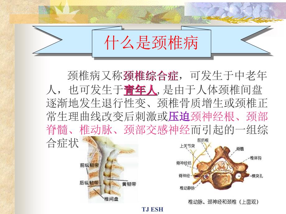 办公室预防颈椎病.ppt_第2页