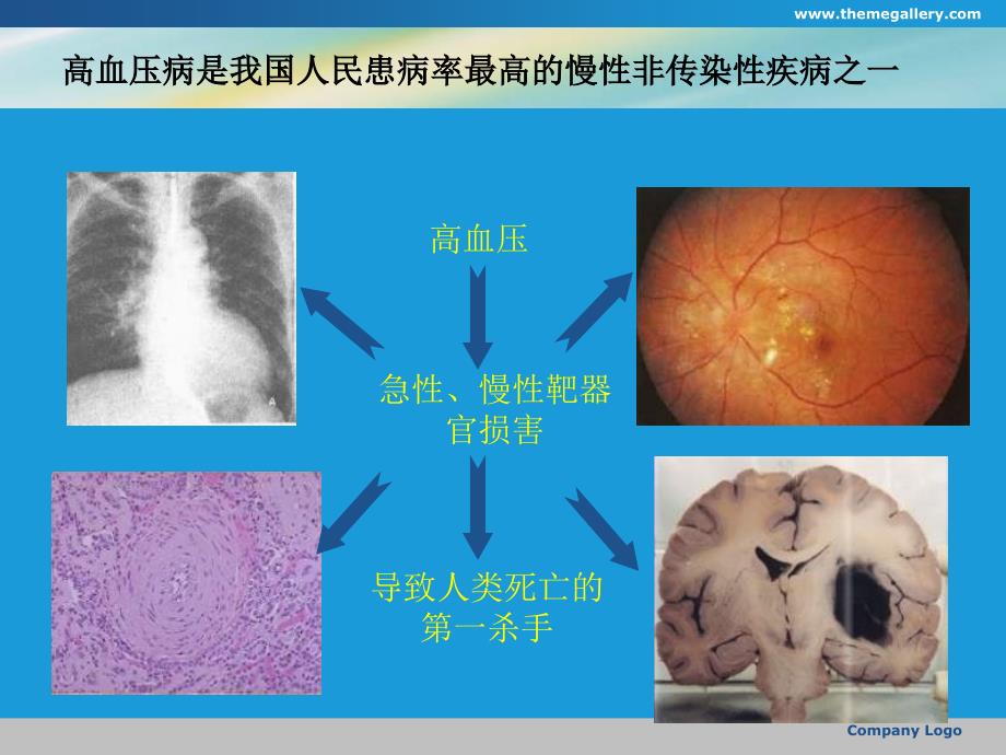 降压治疗对循环内皮微颗粒水平与动脉弹的影响_第3页